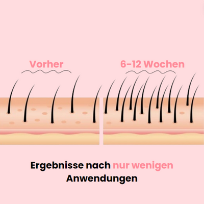 HaarPuls™ - Hochfrequenzstab für Haarwachstum